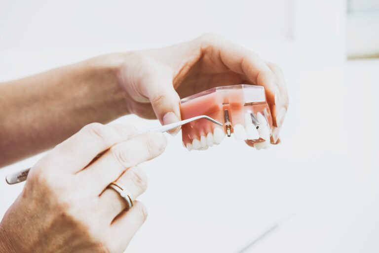 nightmares-person-wearing-silver-colored-ring-while-holding-denture.jpg